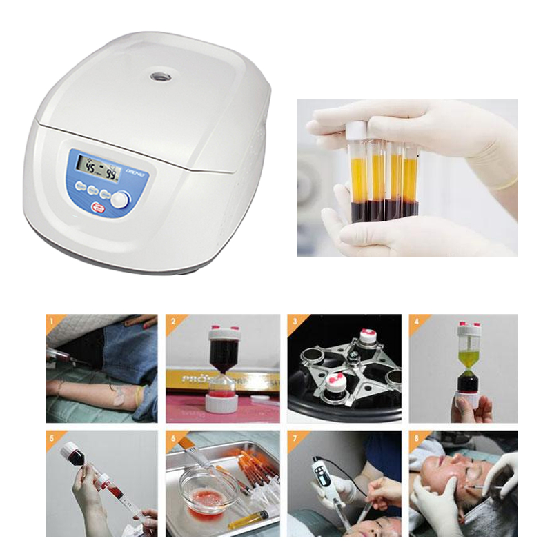 Best Seller Medical Blood PRP  - đánh giá và giá Medical Lab Center